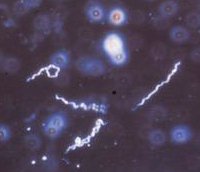 Borrelia burgdorferi, the causative agent of Lyme disease